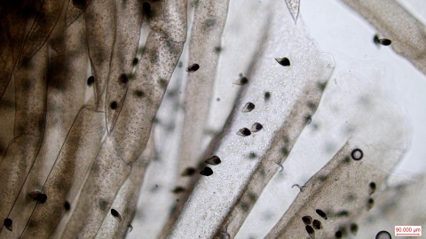 Silty pond mussel larvae under magnification