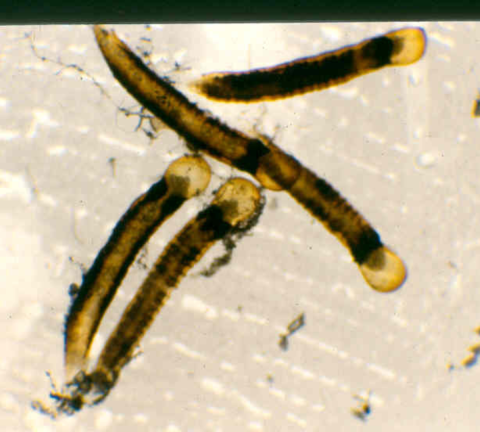 Photo of freshwater mussels' “baby packages,” called conglutinates.