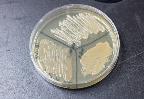 Petri dish filled with agar and divided into thirds. Each third has a culture growing in it. 