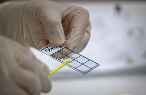 two hands holding a glass slide