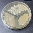 Petri dish filled with agar and divided into thirds. Each third has a culture growing in it. 