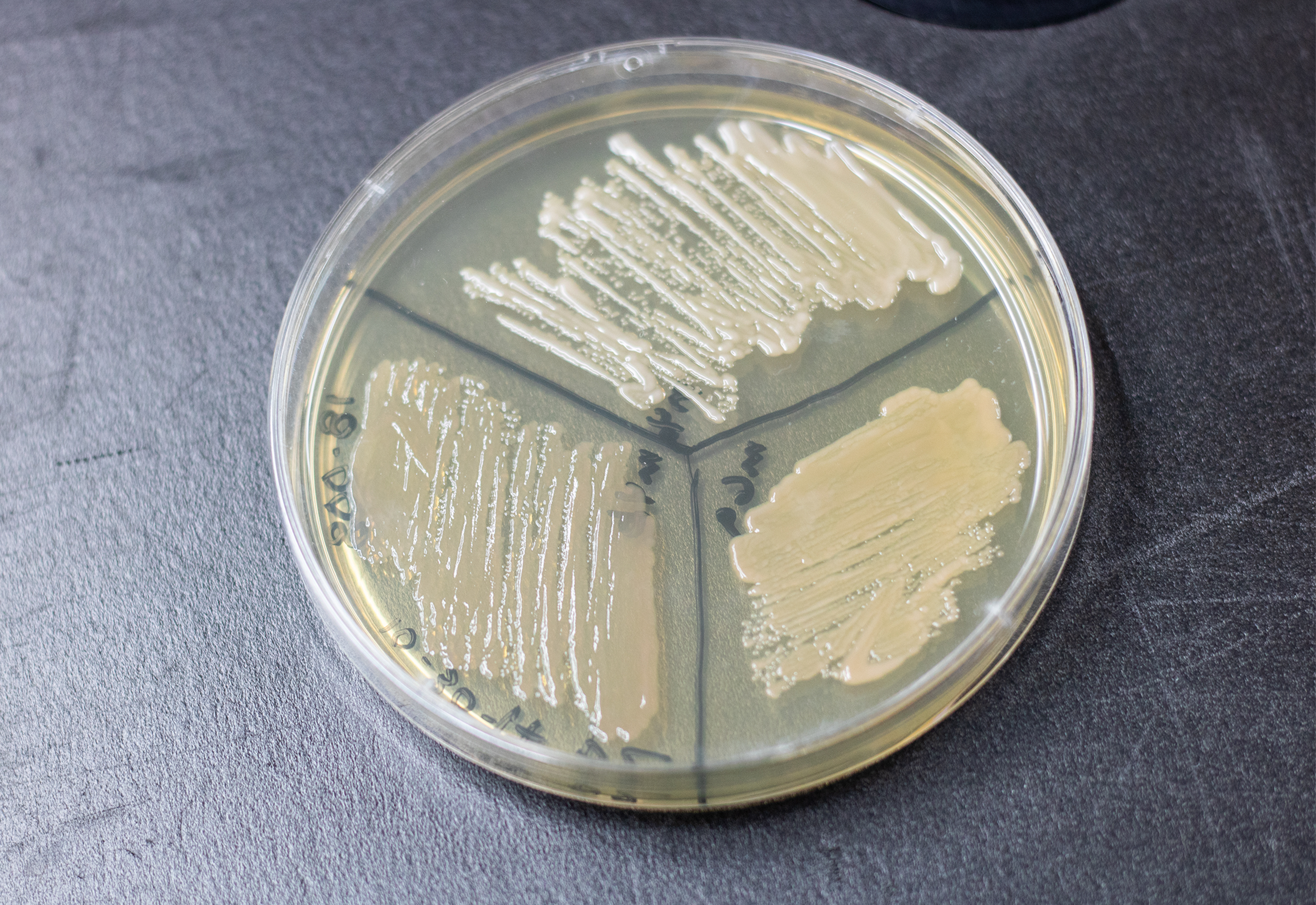 Petri dish filled with agar and divided into thirds.  Each third has a culture growing in it.  