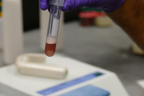Biologist holds vile with sample of fish at Midwest Fisheries Center