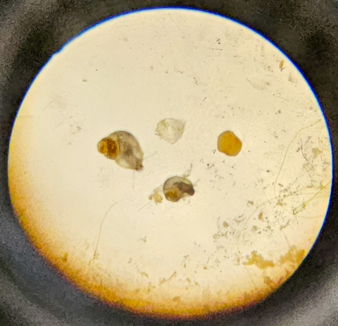 Springsnails as seen through a microscope.