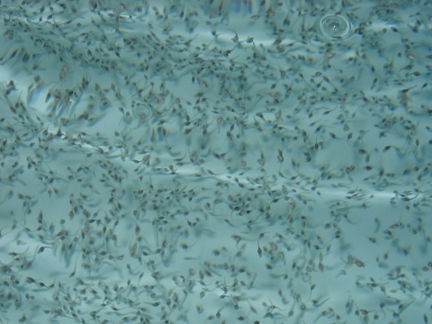 hundreds or very small fish fry in light blue water