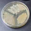 Petri dish filled with agar and divided into thirds. Each third has a culture growing in it. 